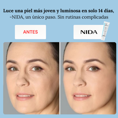 Crema Hidratación Profunda, Adiós a las Arrugas -NIDA™
